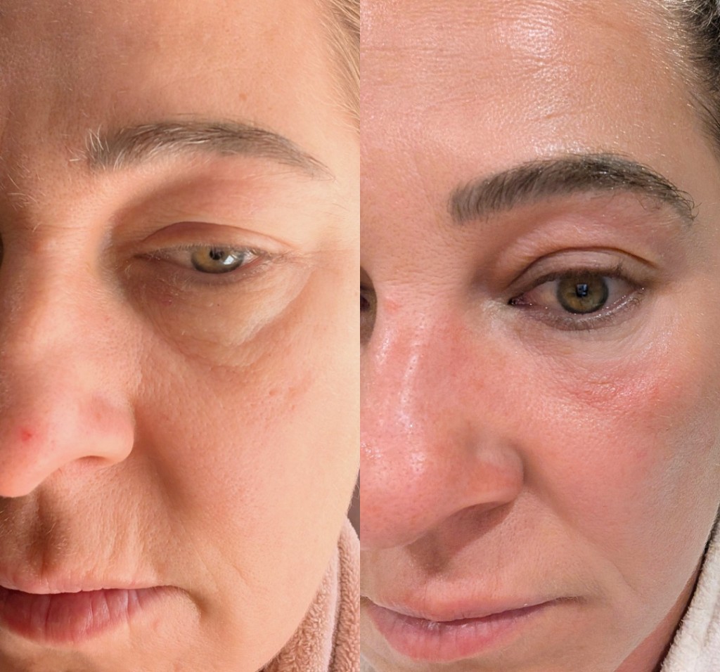 The Eye Cream before and after image